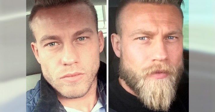 A következő fotók bebizonyítják, hogy a szakáll drámaian megváltoztatja a férfiak kinézetét