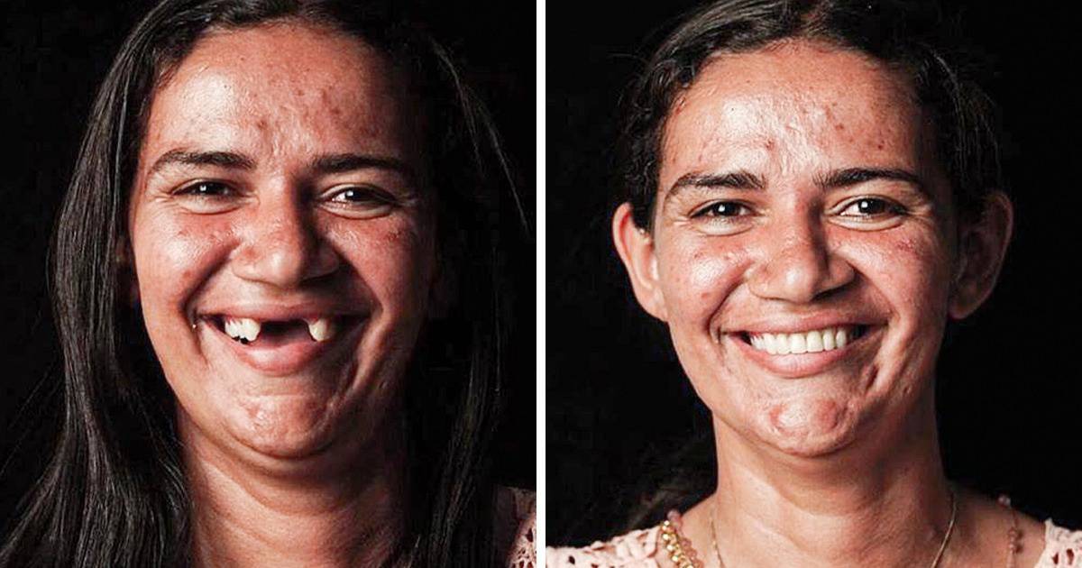 Egy brazil fogorvos körbe utazza a világot, hogy visszahozza a mosolyt a szegények arcára ingyen