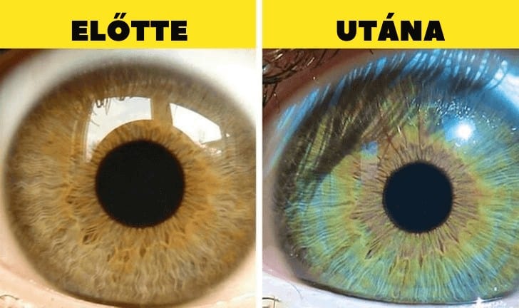 7 dolog, ami megváltoztathatja a szemed színét