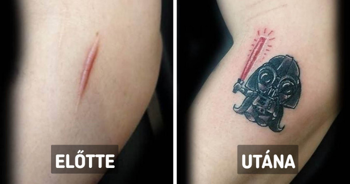 17 tetoválás, amely segített elrejteni vagy kiegészíteni valamit és visszaadni az emberek önbizalmát